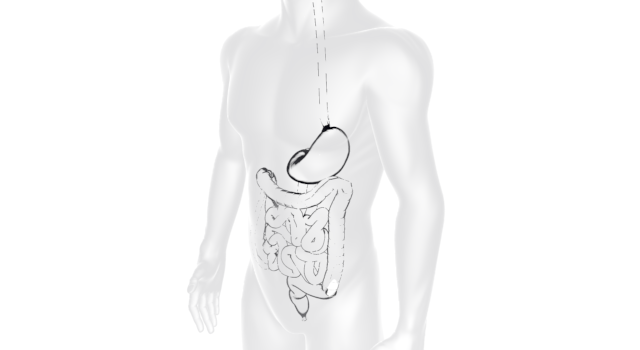 内蔵｜胃｜小腸｜人の体｜炎症/痛み｜赤く腫れる/炎症 - 医療/病気/介護/病院/人物/写真/イラスト/無料ダウンロード