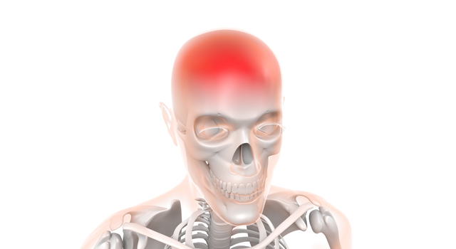 頭痛｜頭蓋骨｜病気/赤色｜医療器具/テクノロジー｜あばら骨/胸部 - 医療/病気/介護/病院/人物/写真/イラスト/無料ダウンロード