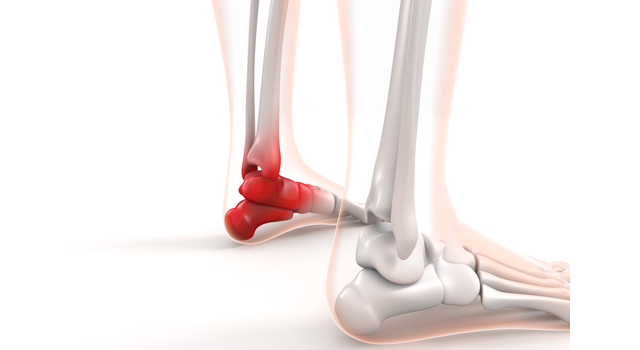 足首が痛い｜赤く｜捻挫/骨｜医療施設/問診｜人体/解説 - 医療/病気/介護/病院/人物/写真/イラスト/無料ダウンロード