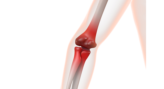 関節痛｜関節炎｜肘関節痛/腕｜病/やまい｜医療施設/大型病院 - 医療/病気/介護/病院/人物/写真/イラスト/無料ダウンロード