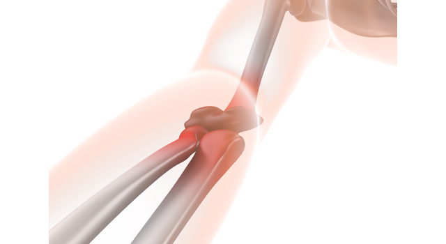 痛み｜関節｜関節炎/肘関節痛｜心臓/肺/健康｜手術台/ドクター - 医療/病気/介護/病院/人物/写真/イラスト/無料ダウンロード