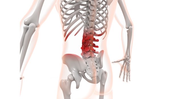 腰痛｜ぎっくり腰｜慢性腰痛/ヘルニア｜食欲/睡眠/薬｜ヘモグロビン/赤血球 - 医療/病気/介護/病院/人物/写真/イラスト/無料ダウンロード