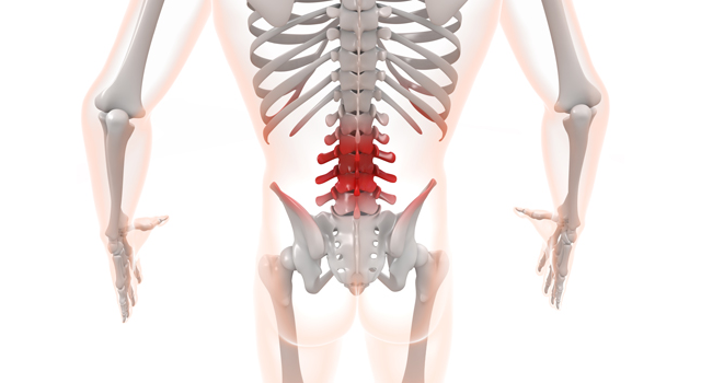 腰｜痛い｜炎症/ヘルニア｜胃/内蔵｜脳/ブレイン - 医療/病気/介護/病院/人物/写真/イラスト/無料ダウンロード