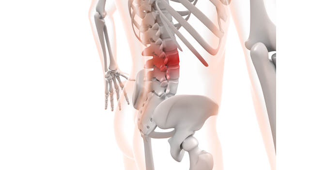 治療｜腰痛｜腰痛/脊椎｜科学/医学｜人体/解説 - 医療/病気/介護/病院/人物/写真/イラスト/無料ダウンロード