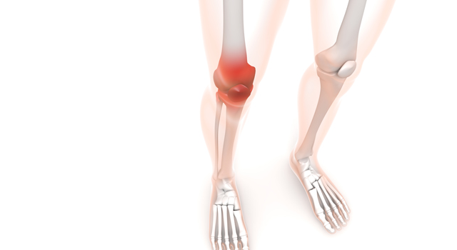 赤い｜膝関節｜炎症/治療｜白衣/ユニフォーム｜ウイルス/病原菌 - 医療/病気/介護/病院/人物/写真/イラスト/無料ダウンロード