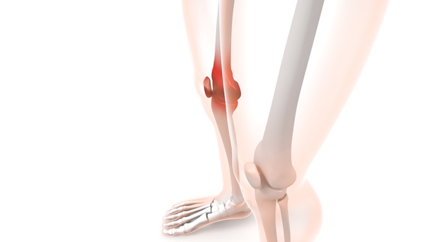 膝関節症｜筋力低下｜軟骨/すり減る｜炎症/痛み｜命令/頭脳 - 医療/病気/介護/病院/人物/写真/イラスト/無料ダウンロード