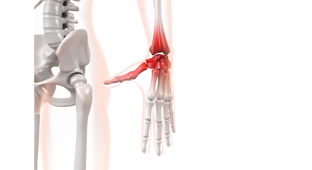 手首｜関節｜炎症/赤い｜レントゲン/診察｜移動ベッド/救急 - 医療/病気/介護/病院/人物/写真/イラスト/無料ダウンロード