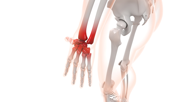 捻挫｜手首｜関節/治療｜人間ドック/MRI｜看護婦/看護師 - 医療/病気/介護/病院/人物/写真/イラスト/無料ダウンロード