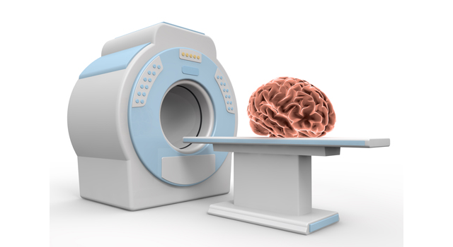 MRI｜脳｜医療機器/総合施設｜炎症/痛み｜薬/キャラクター - 医療/病気/介護/病院/人物/写真/イラスト/無料ダウンロード