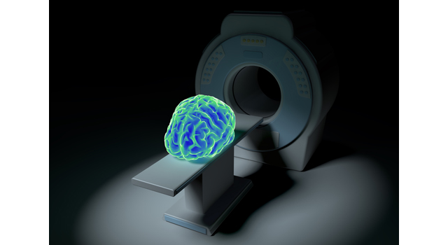 検査｜脳｜医学/MRI｜治療/手術｜お年寄り/老人 - 医療/病気/介護/病院/人物/写真/イラスト/無料ダウンロード