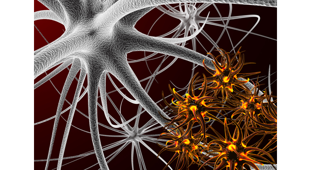 細胞/ばい菌｜ウイルス/攻撃｜頭蓋骨/脳｜看護士/補助 - 医療/病気/介護/病院/人物/写真/イラスト/無料ダウンロード