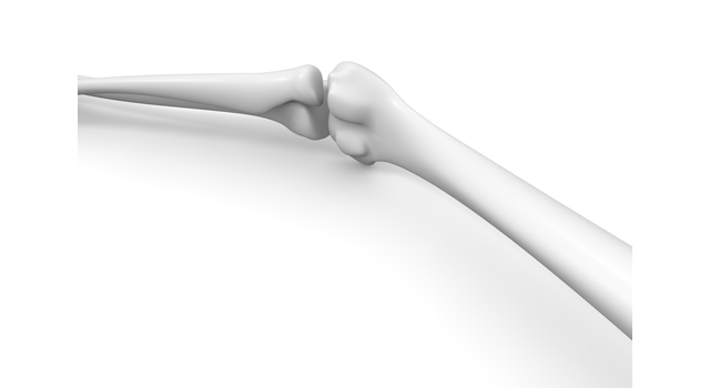 骨｜関節｜軟骨/老化｜粉砕/折れる｜看護士/補助 - 医療/病気/介護/病院/人物/写真/イラスト/無料ダウンロード