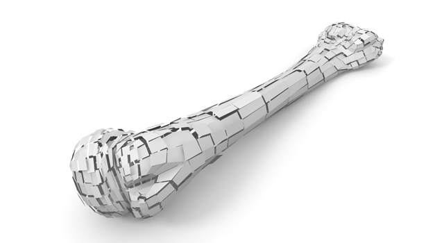 ひび｜骨｜粉砕/ケガ｜点滴/発熱｜医療施設/大型病院 - 医療/病気/介護/病院/人物/写真/イラスト/無料ダウンロード