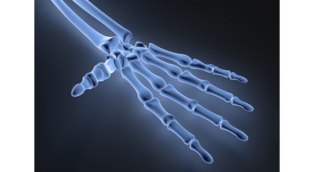 ハンド｜レントゲン｜構造/手｜科学/医学｜医療施設/大型病院 - 医療/病気/介護/病院/人物/写真/イラスト/無料ダウンロード