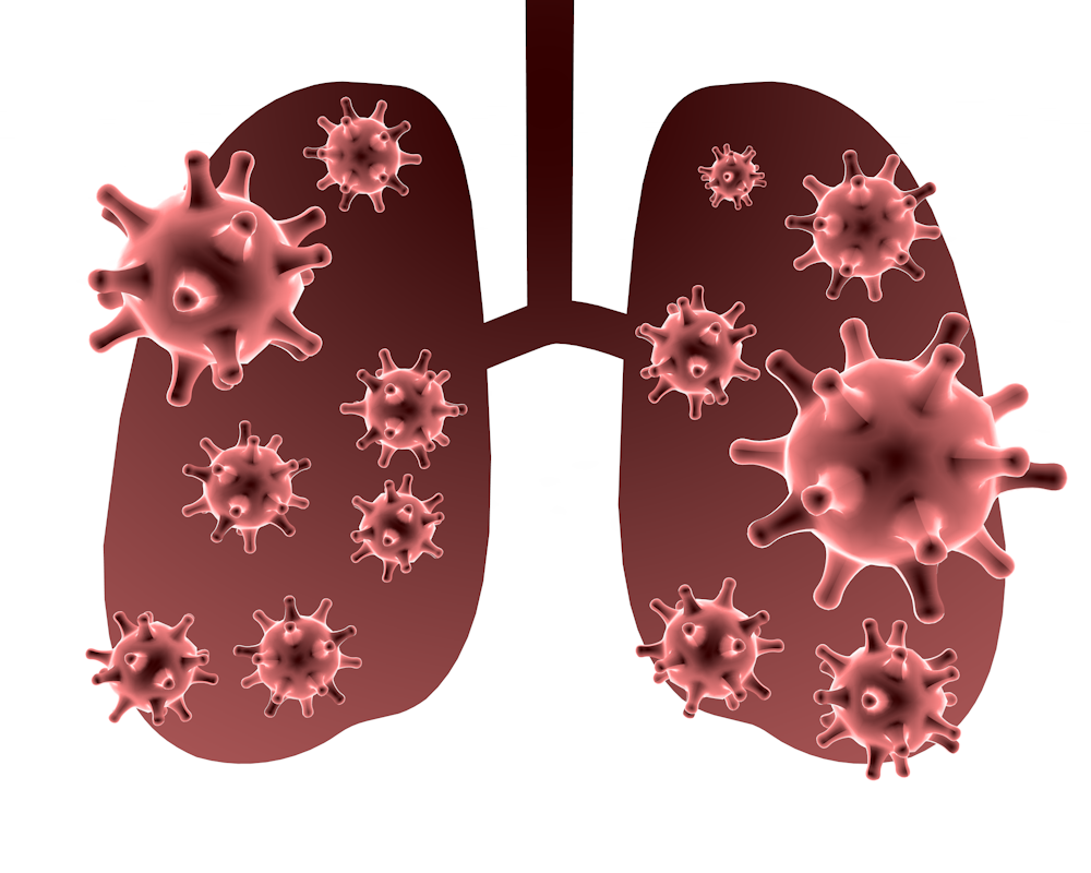 新型コロナ感染者｜重症者｜全国 - 医療/病気/介護/病院/人物/写真/イラスト/無料ダウンロード