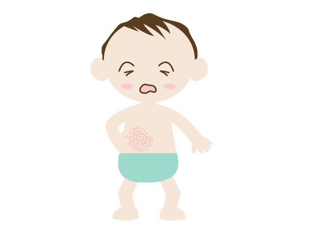 赤ん坊 | 肌 | トラブル - 医療/病院/人物/写真/クリップアート/フリー素材/介護/福祉